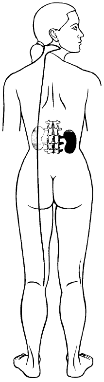 Kidney divergent channel