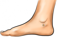acupressure points for heel pain relief