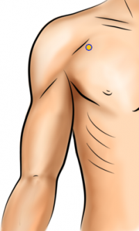 Acupressure Points For Sinus & Chest Congestion (Also Coughing & Wheezing)