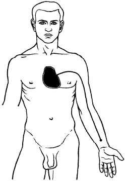 Pericardium luo-connecting channel